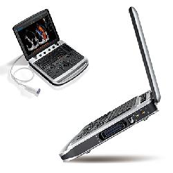 Переносной аппарат УЗИ - SonoBook 8/9 (Sonotouch 80) от CHISON (Китай)